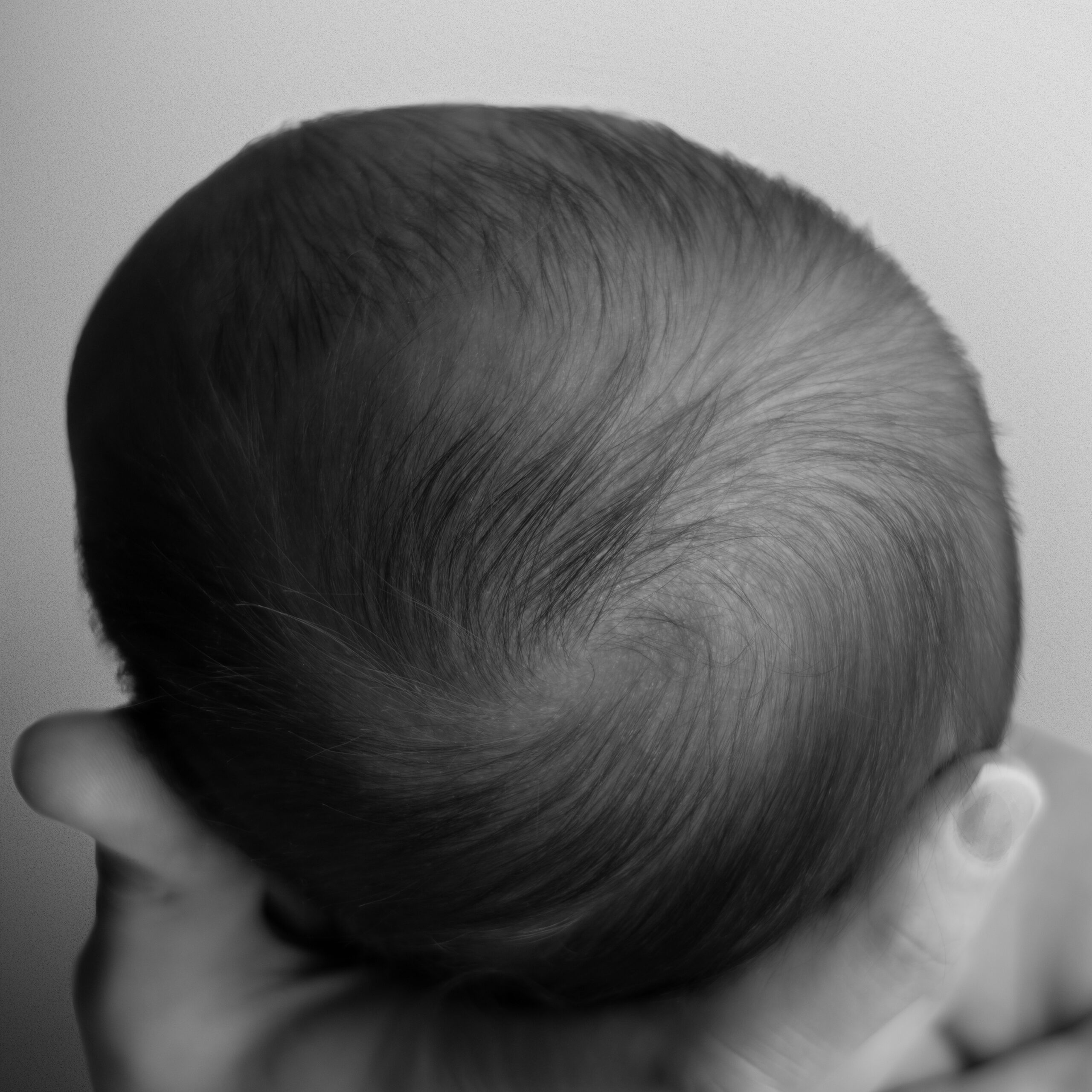Detail of a newborns swirl on to of their head from Minot, ND.